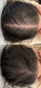 Recuperación de densidad capilar