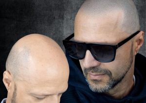 micropigmentacion capilar precio